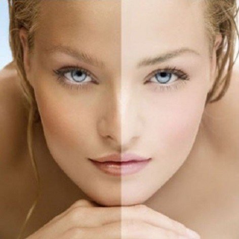 Combi Facial Manchas - Triple Acción + Peeling Medico