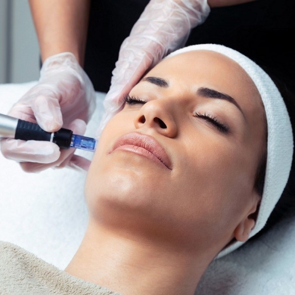 Dermapen facial con microexfoliacion