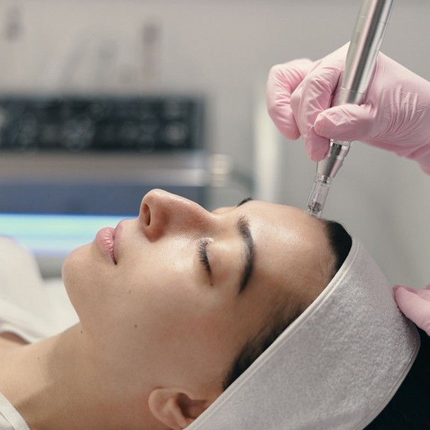 Dermapen facial con microexfoliacion