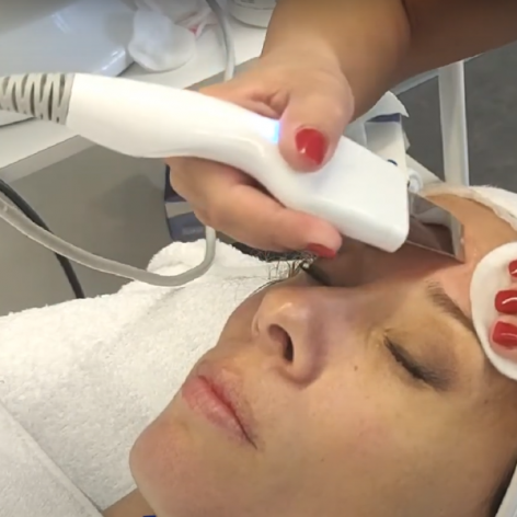 Hidra Aqualift Facial con Peeling - 6 en 1