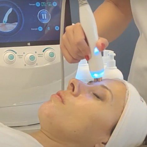 Hidra Aqualift Facial con Peeling - 6 en 1