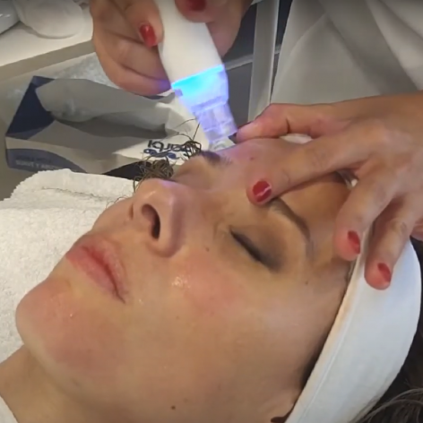 Eternity de Luxe - Pack Hidra Aqualift Facial + Hifu 7D Facial - PROMO ESPECIAL