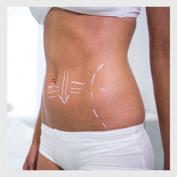 EVO Definitive 3D - Remodelación corporal