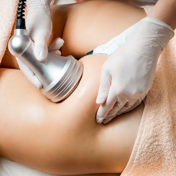 Tratamiento corporal para perder peso Style Body